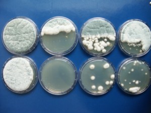 Mikrobiologische Laboruntersuchung 32B0