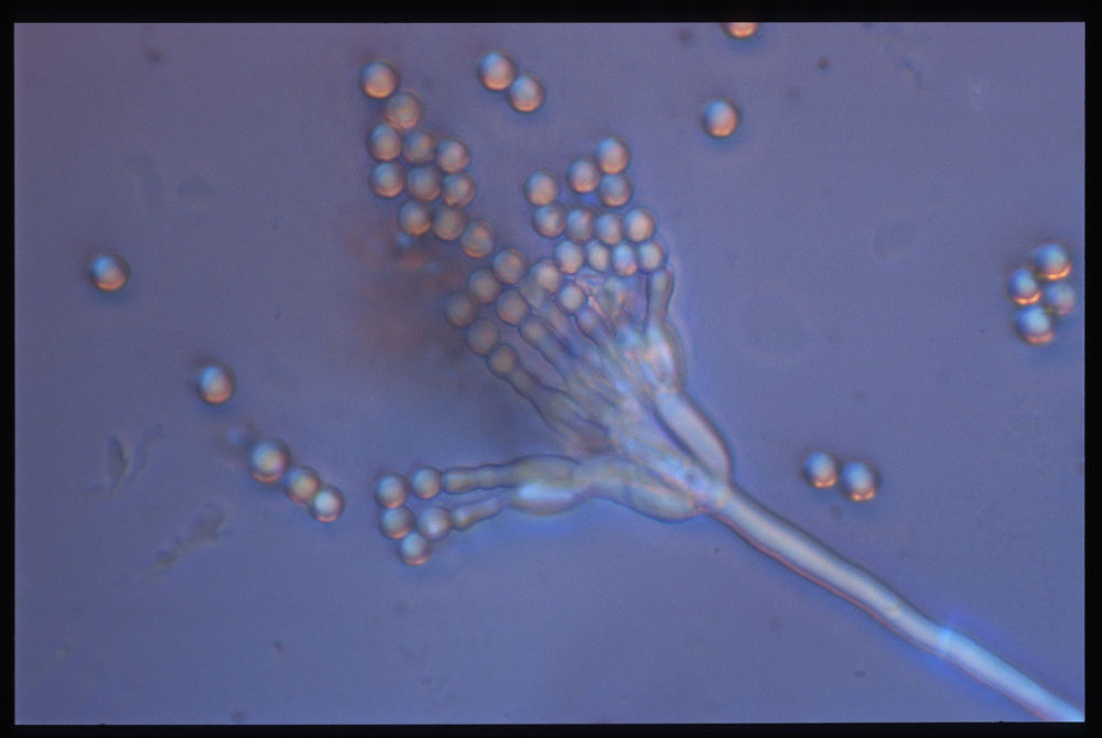 Mikrobiologische Untersuchung von Schimmelsporen