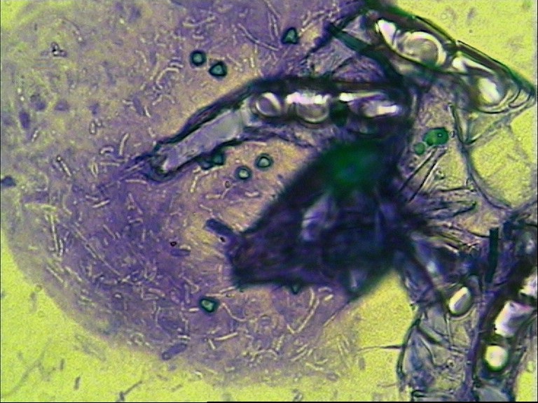 Phase 2 - Bakterienkolonie an der toten Milbe, erste Pilzsporenbildung erkennbar
