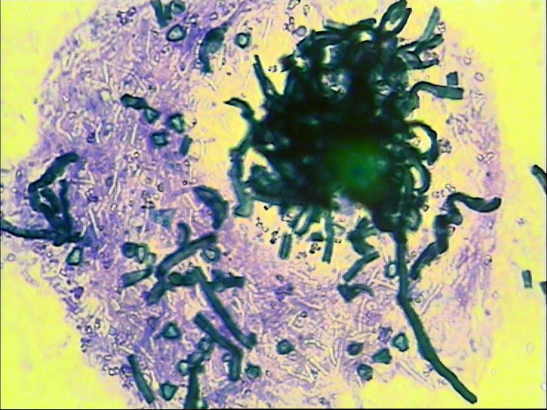 Phase 3 - "Schwärzepilze" wachsen auf der Bakterienkolonie (lila) aus