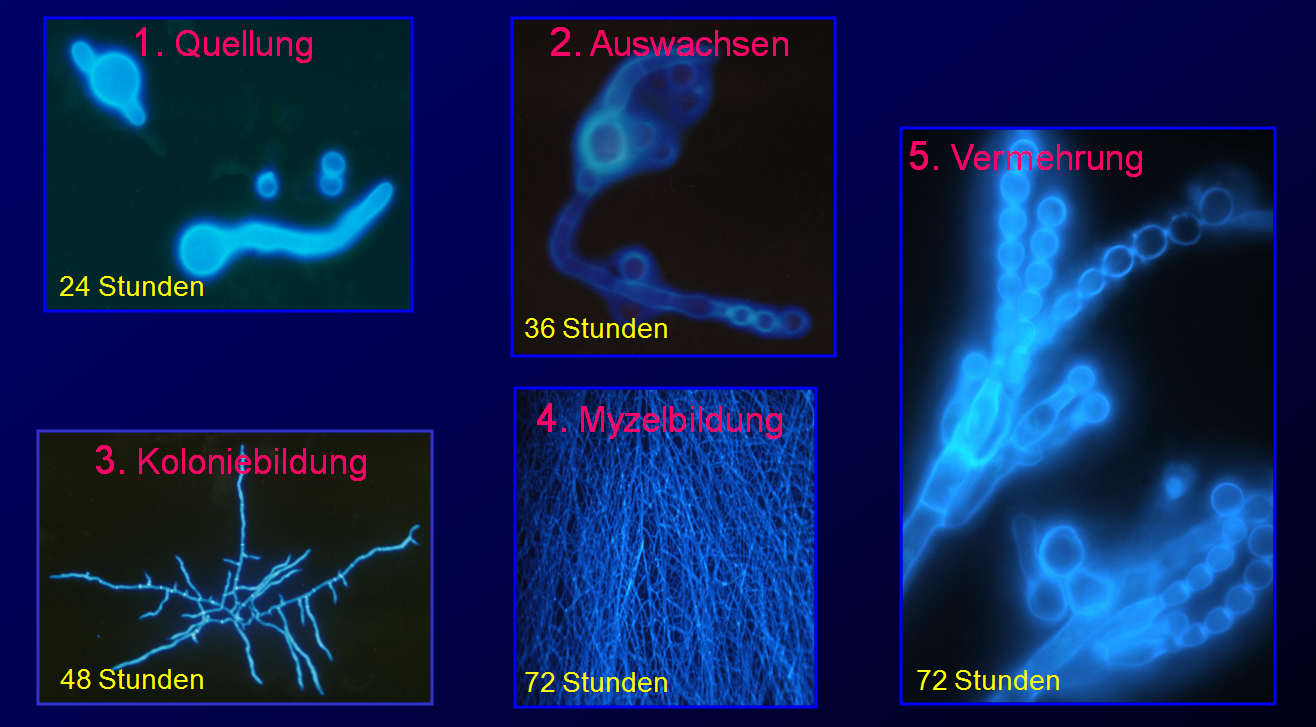 Do-It-Yourself Schimmeltest - Messung und Untersuchung von  Schimmelpilzsporen in der Raumluft